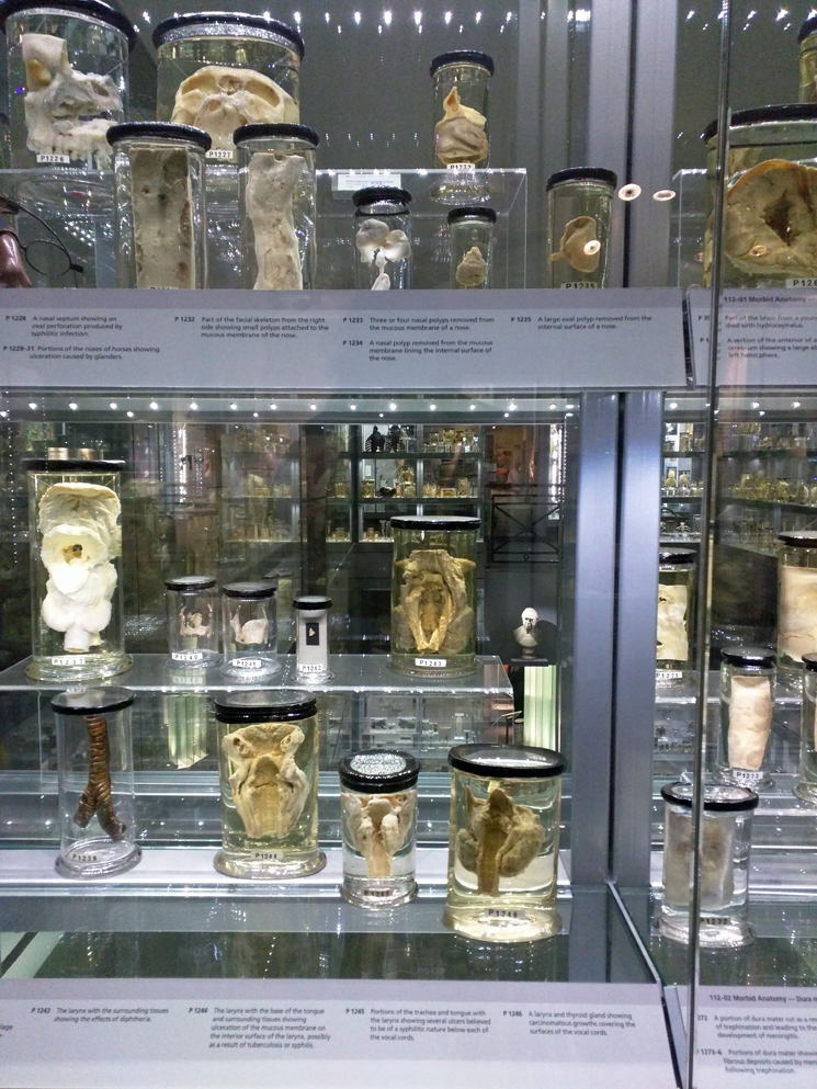 Hunterian Museum (2)